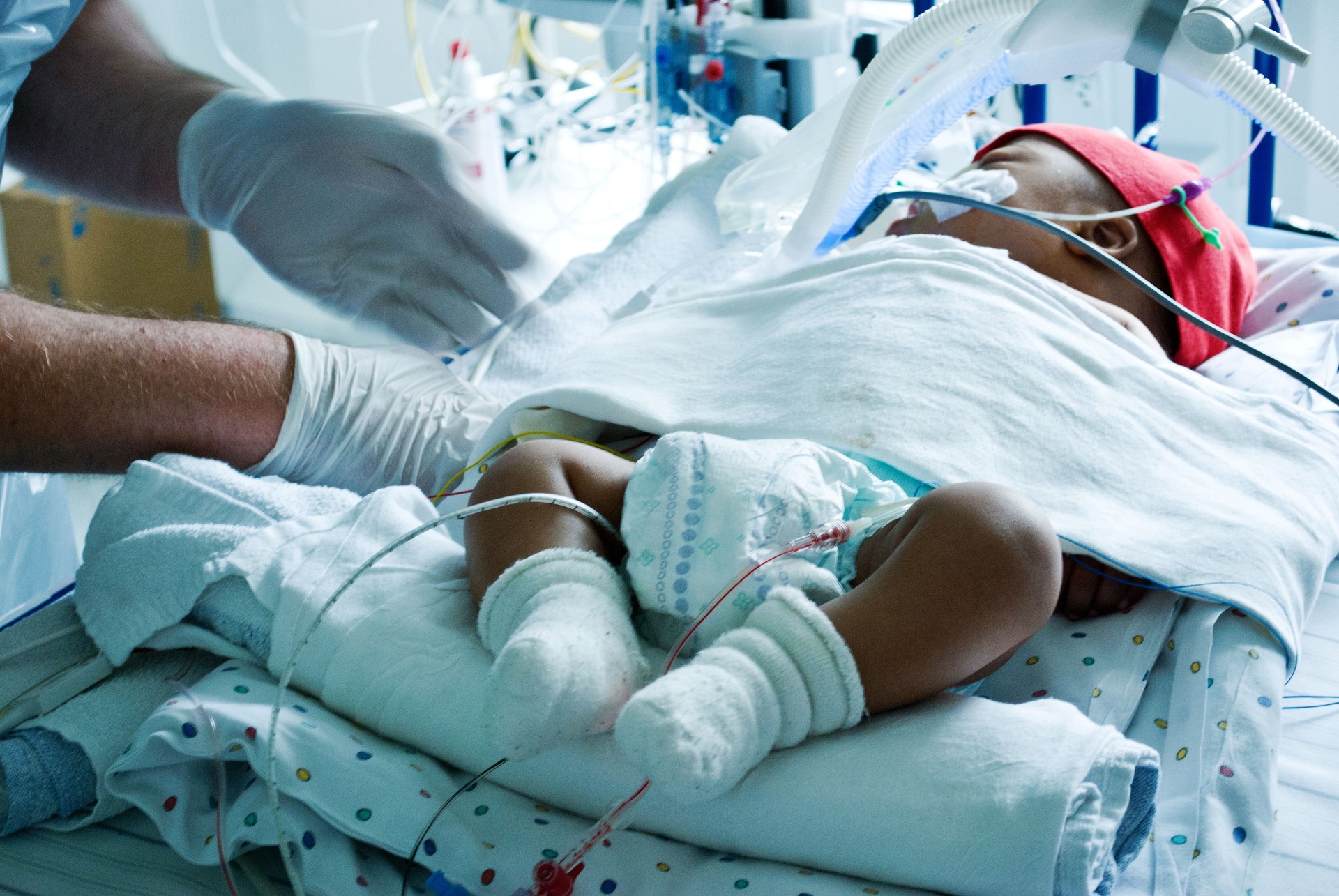 A doctor taking care of a critically sick baby hooked on a ventilator in a hospital paediatric intensive care ward